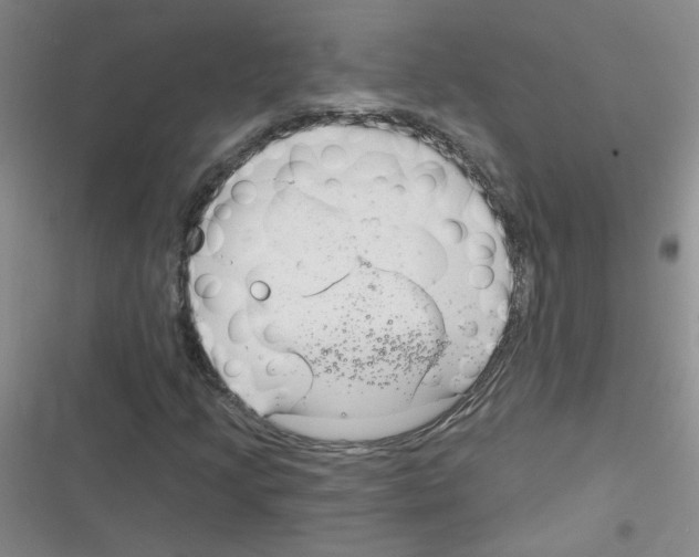 X0000116341205201001131038