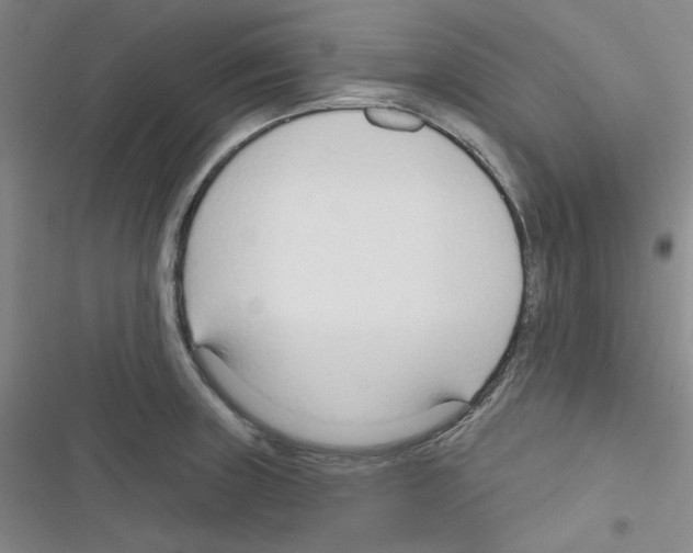 X0000116341235201001131038