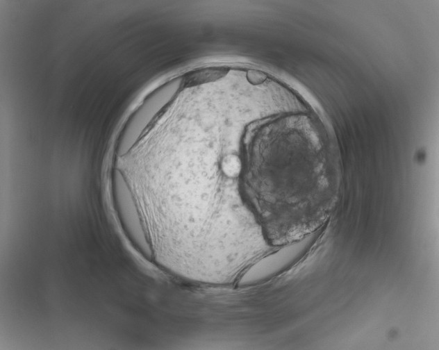 X0000116341245201001131039