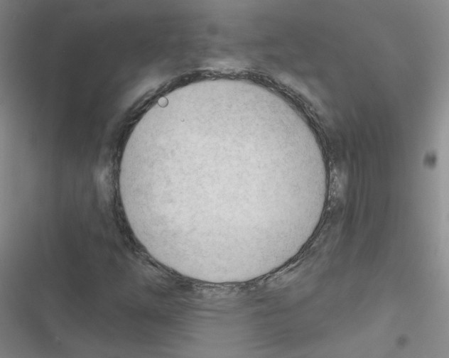 X0000116341254201001131038