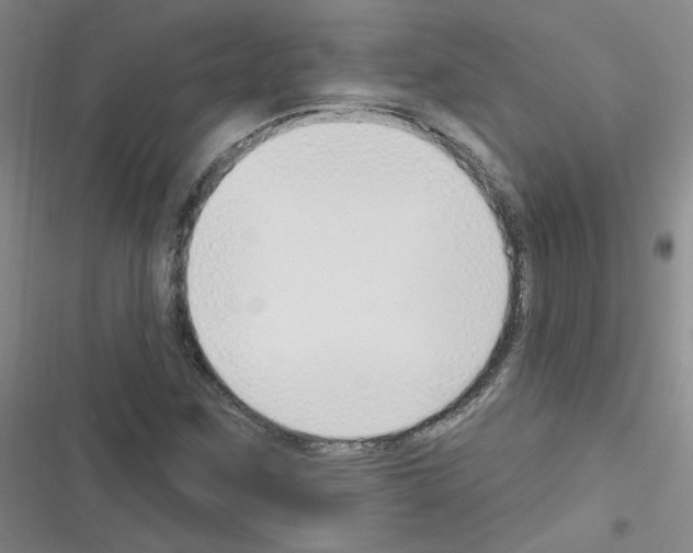 X0000116341259201001131038