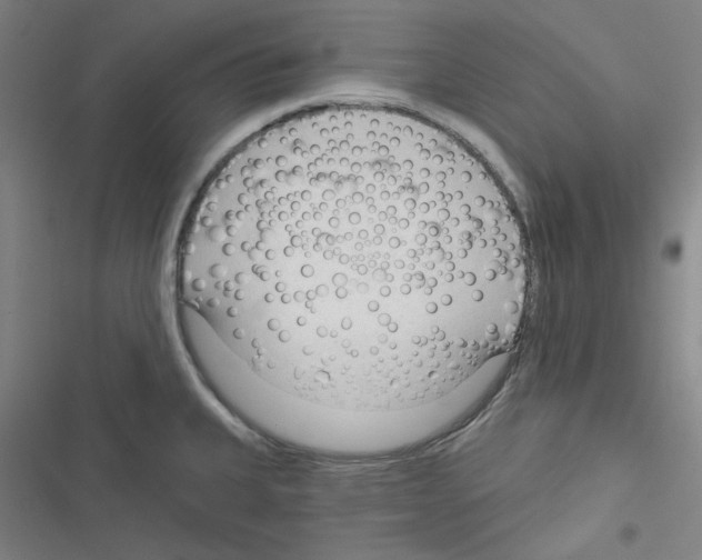 X0000116341335201001131037