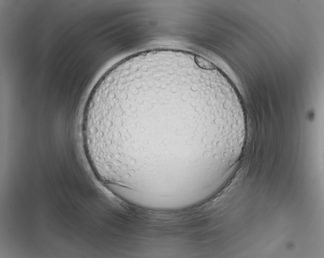 X0000116341339201001131037