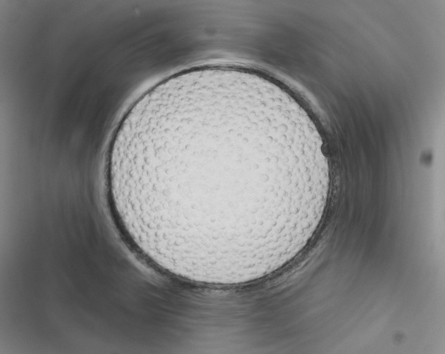 X0000116341375201001131036