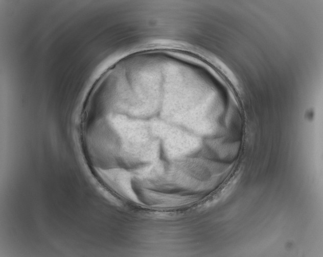 X0000116341381201001131036