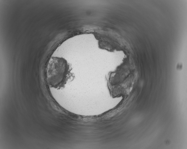 X0000116341393201001131035