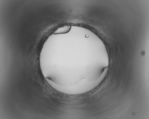 X0000116341398201001131035