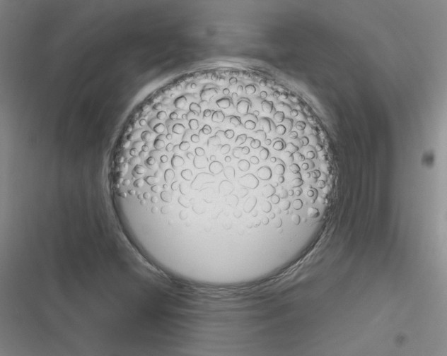 X0000116341404201001131035