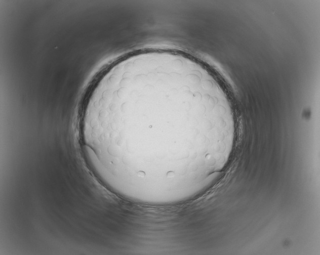 X0000116341408201001131036