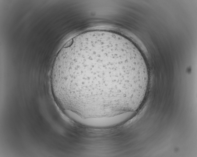 X0000116341425201001131036