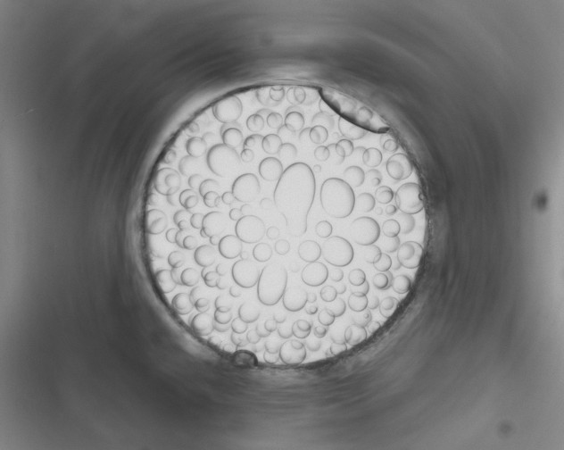 X0000116341432201001131036