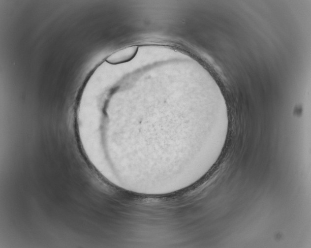 X0000116341463201001131035