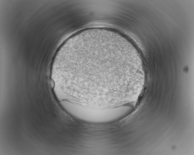 X0000116341465201001131035