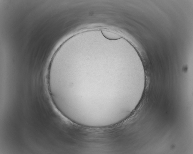 X0000116341527201001131035