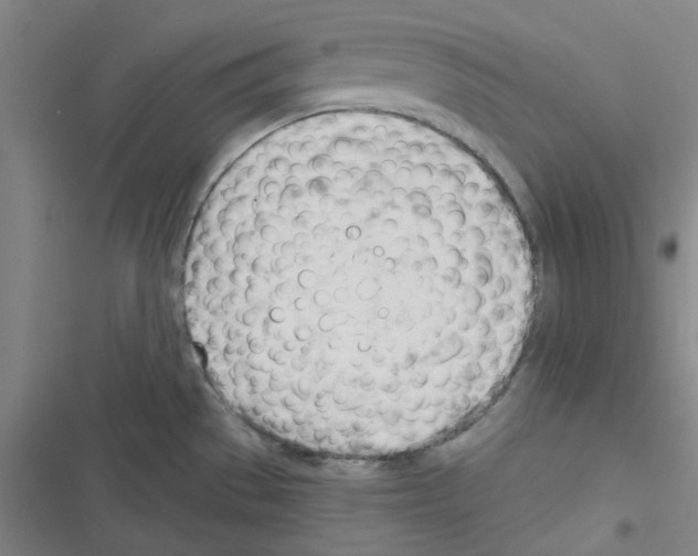 X0000116341529201001131035