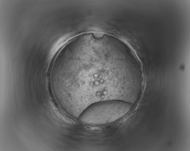 X0000116350151200912151400