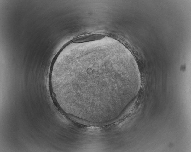 X0000116350052201001131115