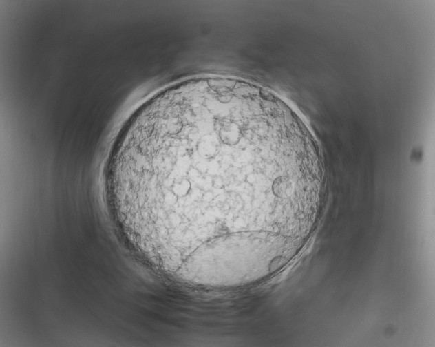X0000116350151201001131113