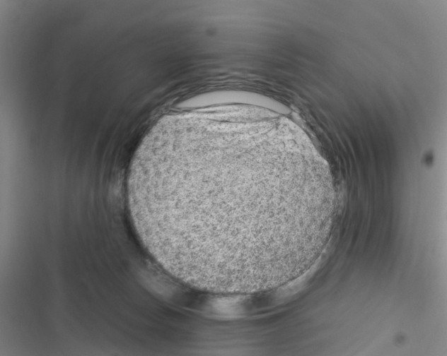X0000116350178201001131114