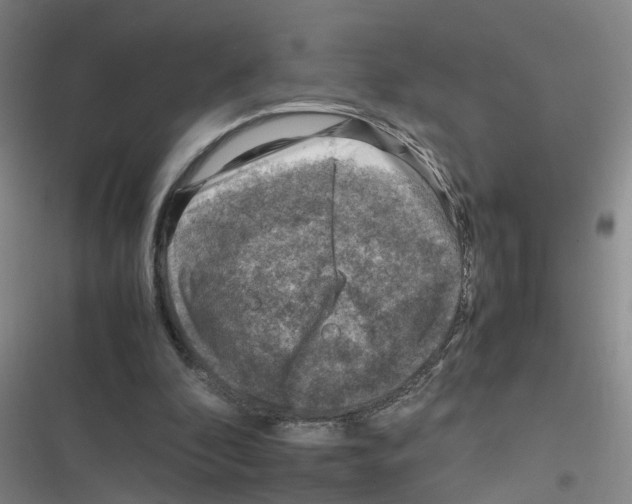 X0000116350296201001131112
