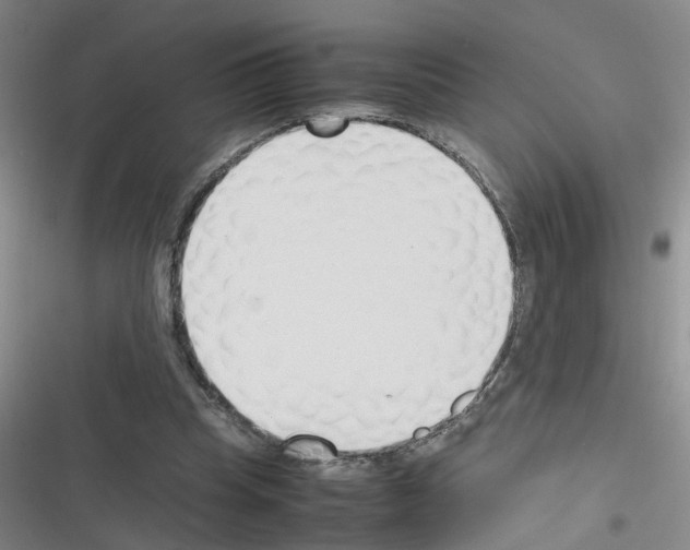 X0000116350345201001131111