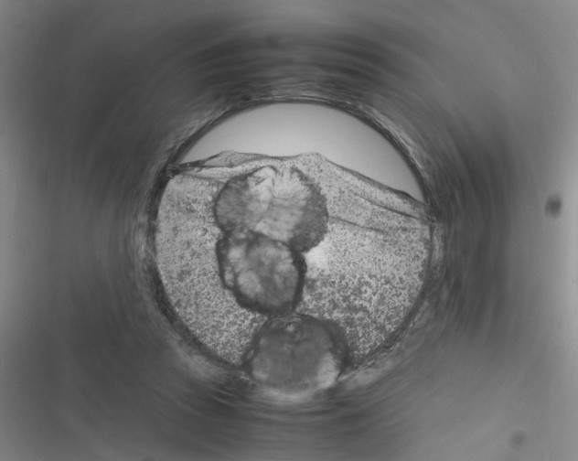 X0000116350353201001131111