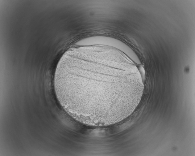 X0000116350366201001131111