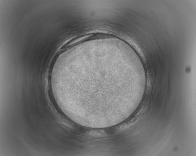 X0000116350386201001131111