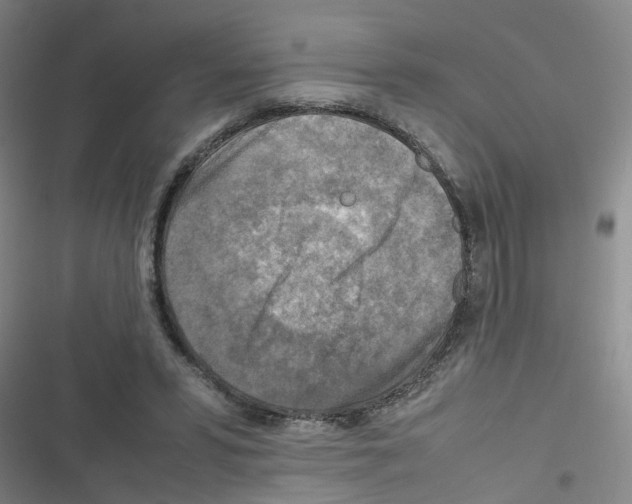 X0000116350399201001131110