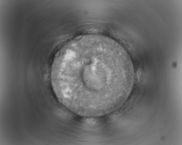 X0000116350423201001131110