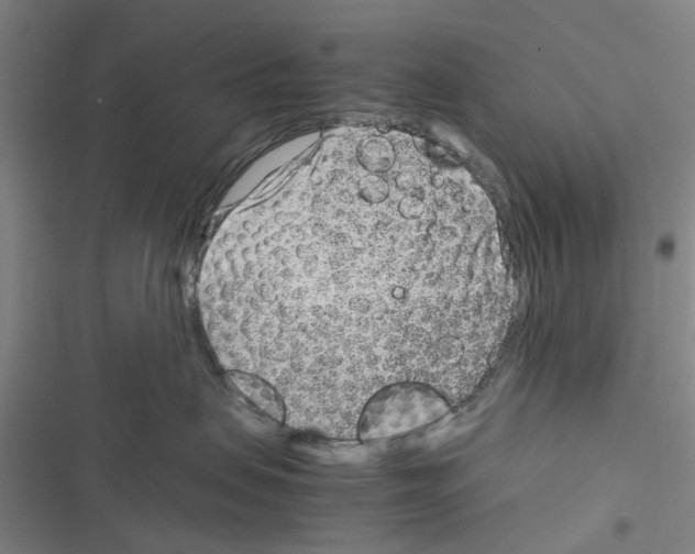 X0000116350479201001131110