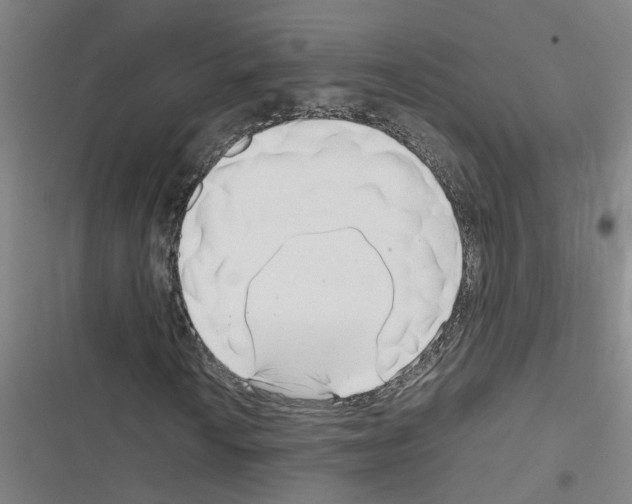 X0000116351010201001131101