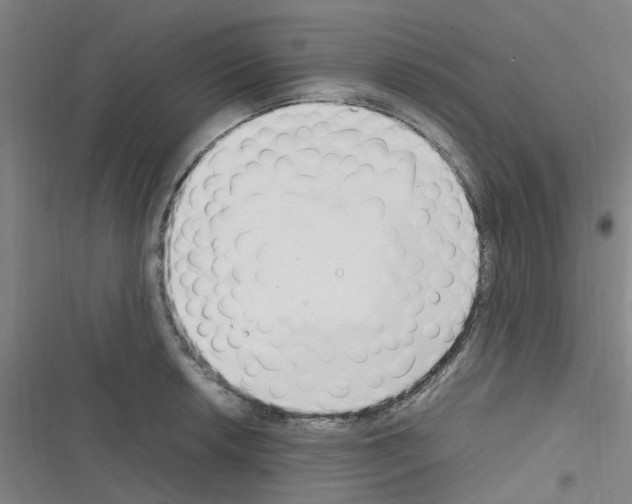 X0000116351042201001131102