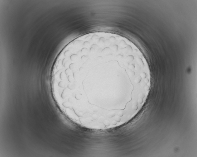 X0000116351050201001131102