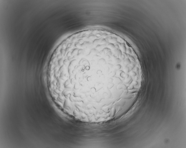 X0000116351054201001131102