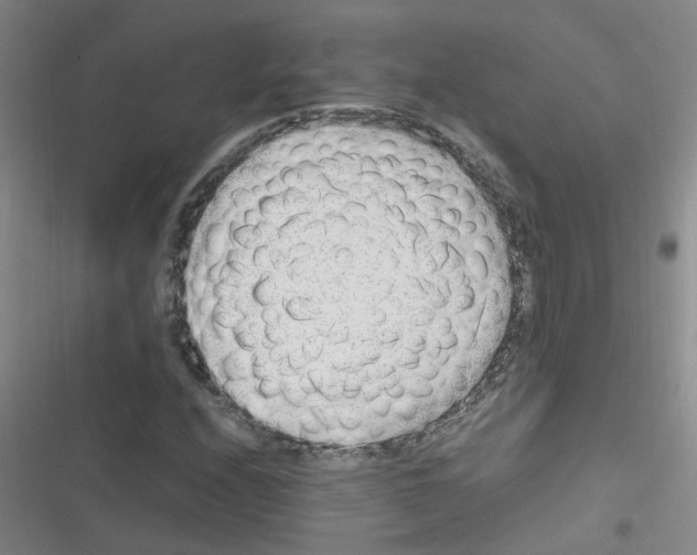 X0000116351208201001131059