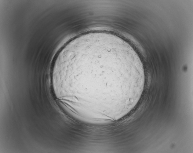 X0000116351274201001131058