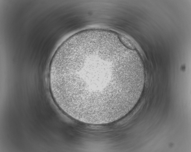 X0000116351295201001131058