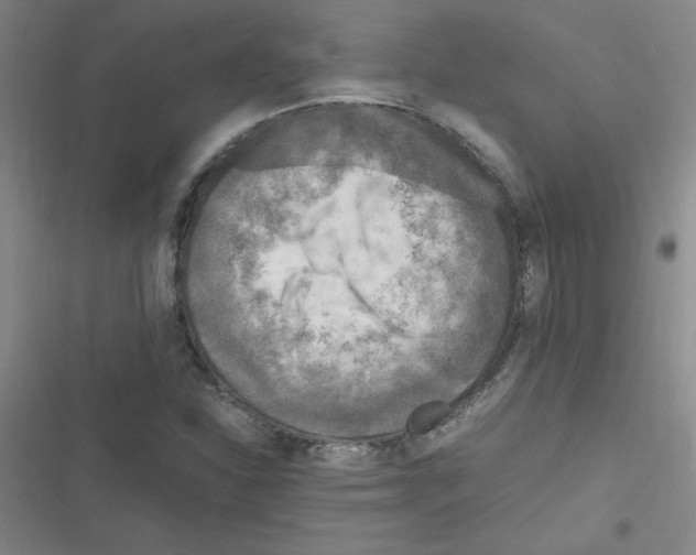X0000116351310201001131058