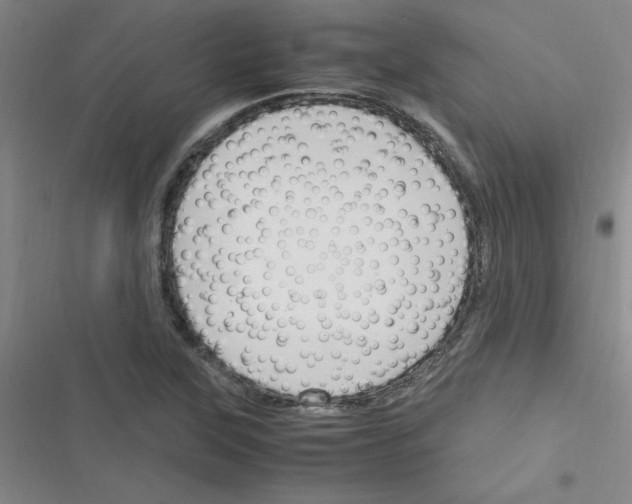 X0000116351315201001131058