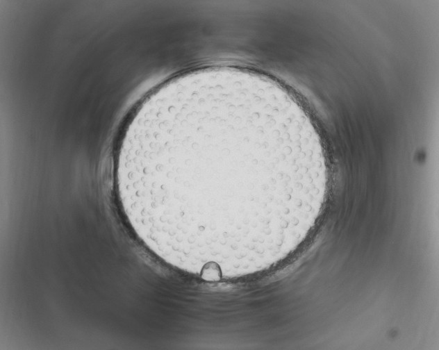 X0000116351317201001131058