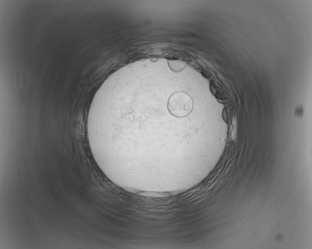 X0000116351395201001131056