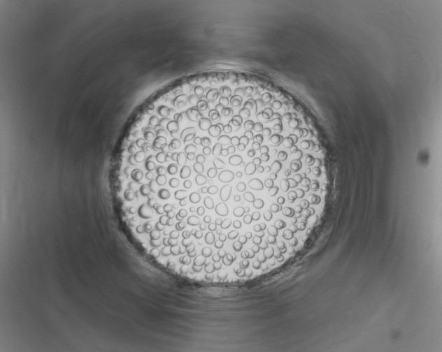 X0000116351404201001131056
