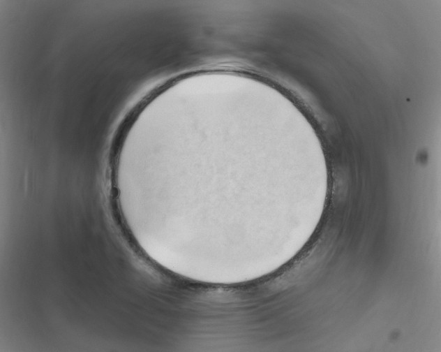 X0000116351414201001131057