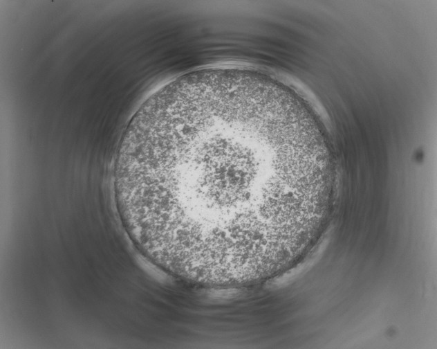 X0000116351425201001131057