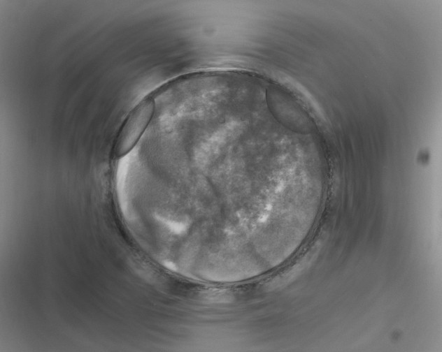 X0000116351457201001131056