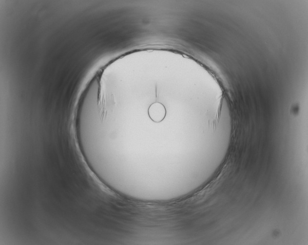 X0000116351472201001131056