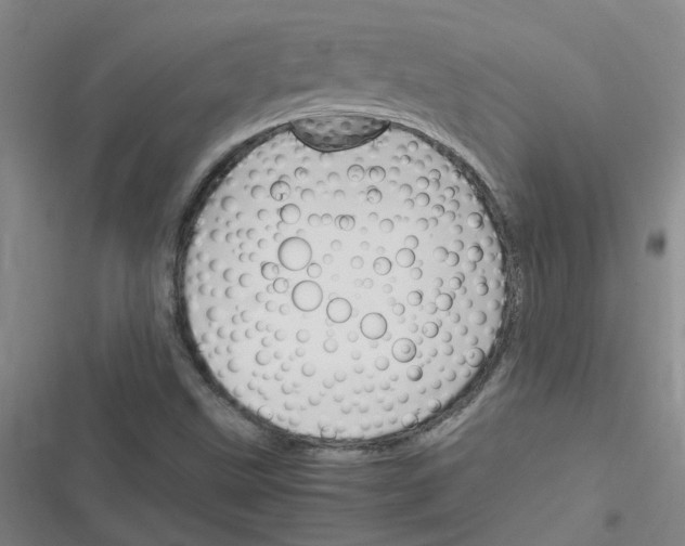 X0000116351499201001131055