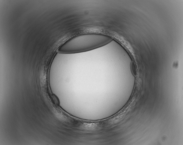 X0000116370057201001131756