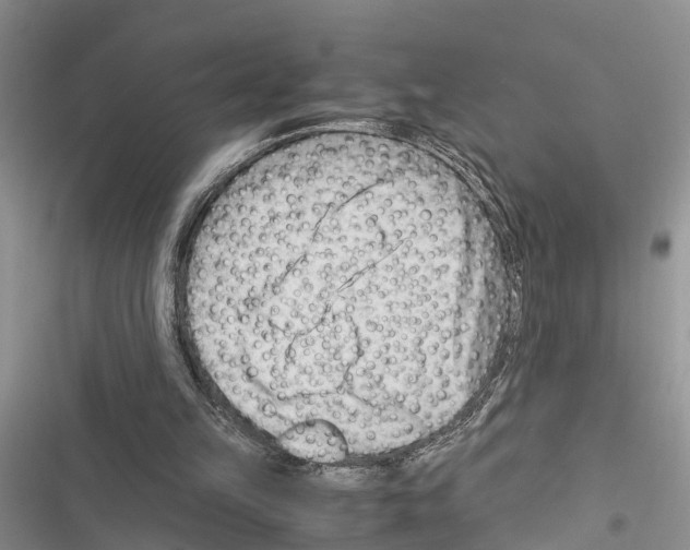 X0000116370149201001131755